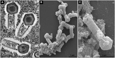 Microscopic Analysis of the Tupanvirus Cycle in Vermamoeba vermiformis